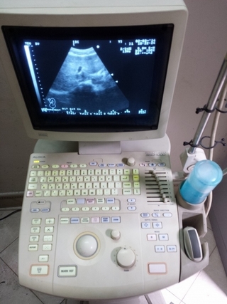 SỬA CHỮA MÁY SIÊU ÂM ĐEN TRẮNG ALOKA 1000